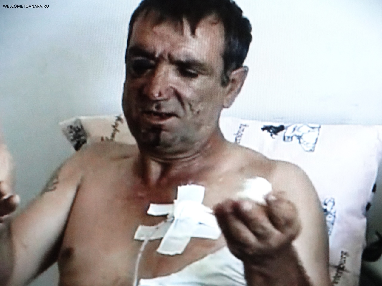 Анапа, Анапа жертвы,